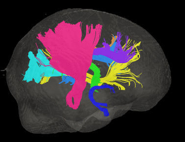 Specific White Matter Tracts