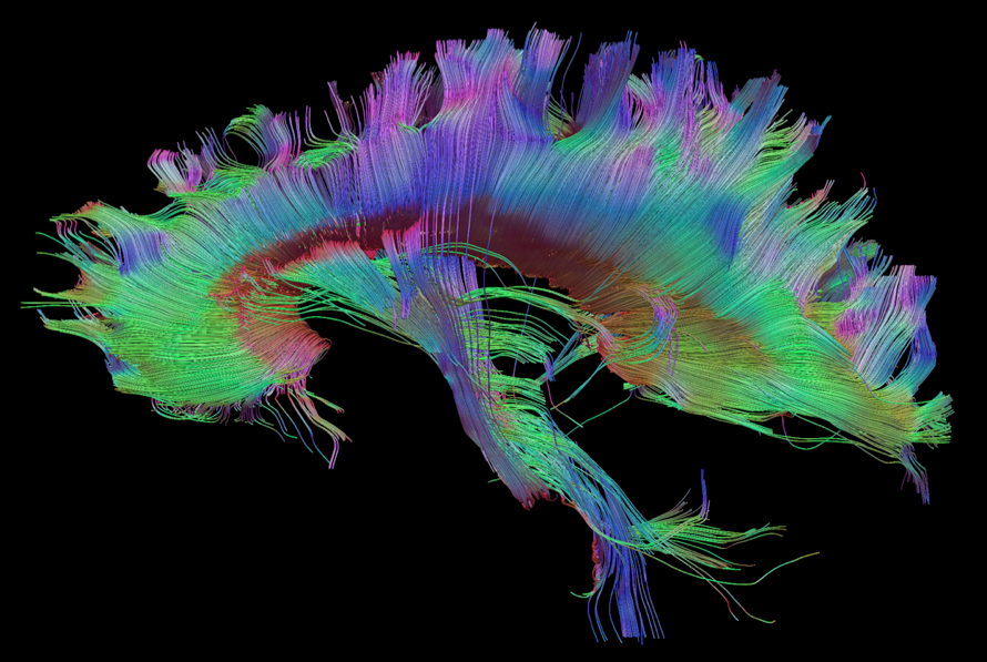 Corpus Callosum Color