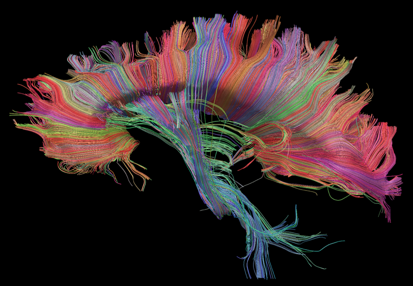 Corpus Callosum Color