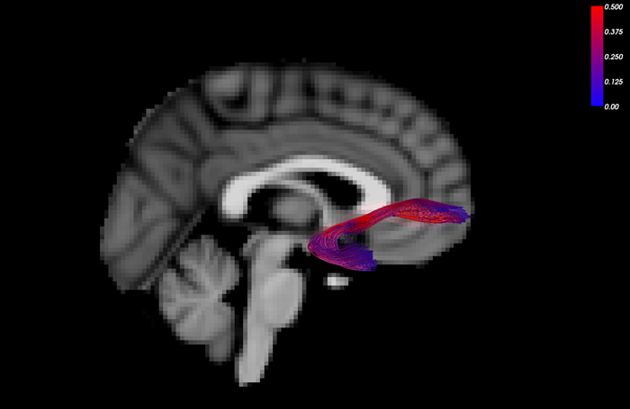 UNC Sagittal